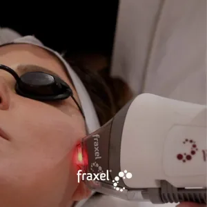 Fraxel Dual